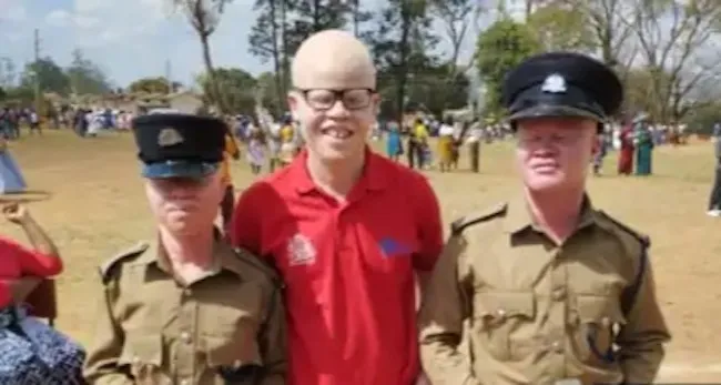police albino