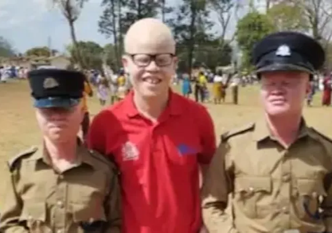 police-albino